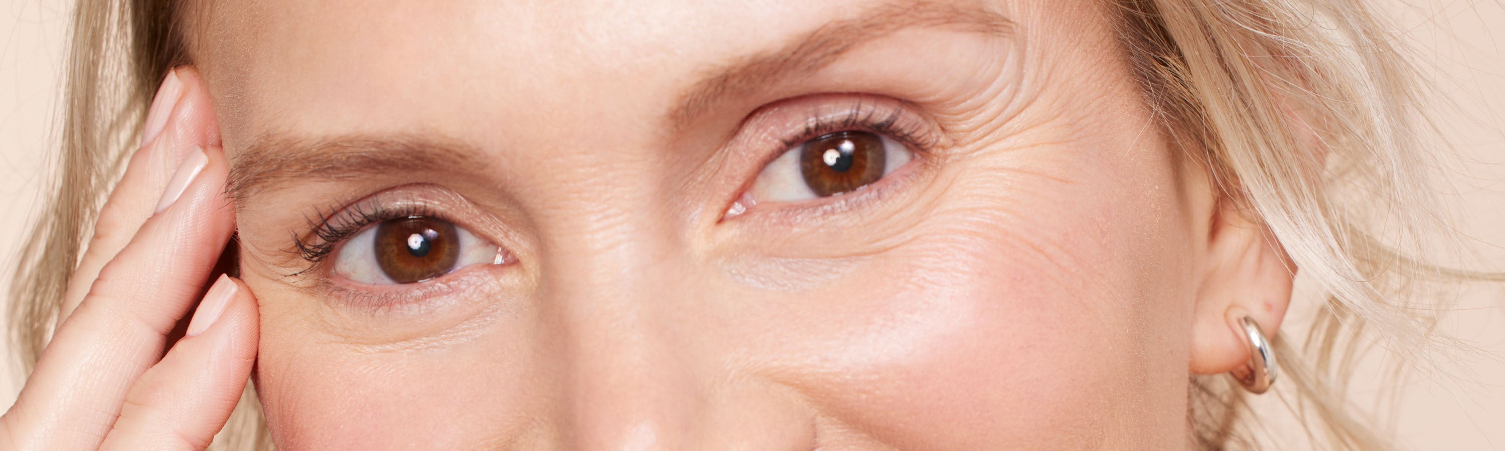 5 things you need to do to banish Dark Circles